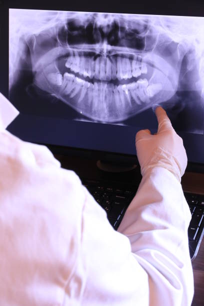 Best Emergency Dental Care for Broken or Chipped Teeth in West Puente Valley, CA