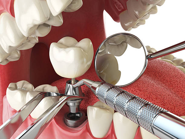 Best Emergency Denture Repair in West Puente Valley, CA